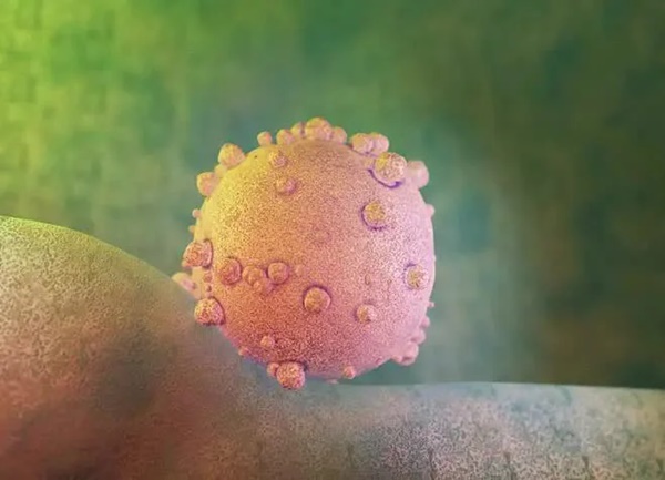 Bác sĩ chia sẻ 1 triệu chứng ung thư tuyến tụy giai đoạn cuối dễ bị bỏ qua vì rất giống với bệnh dạ dày-4