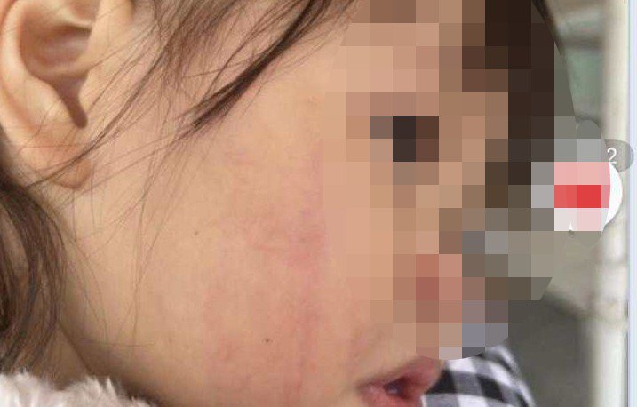 Bị tố đánh liên tiếp vào mặt bé gái 2 tuổi, nữ giáo viên dạy can thiệp ở Hà Nội tường trình gì?-2