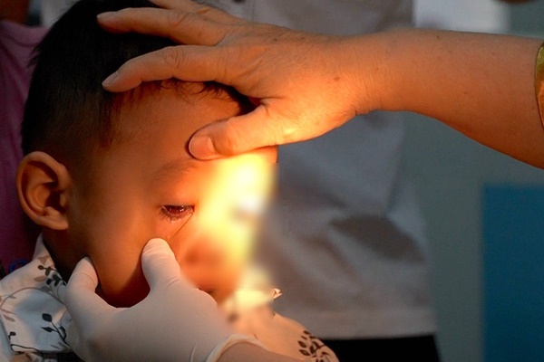 Kết quả bất ngờ về tác nhân gây dịch đau mắt đỏ tại TP.HCM-1