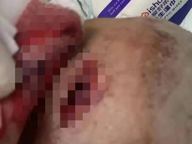 Nữ sinh lớp 4 bị thầy giáo dùng thước tác động vật lý đến mức vỡ hộp sọ, thái độ của hung thủ sau đó càng gây phẫn nộ hơn-2