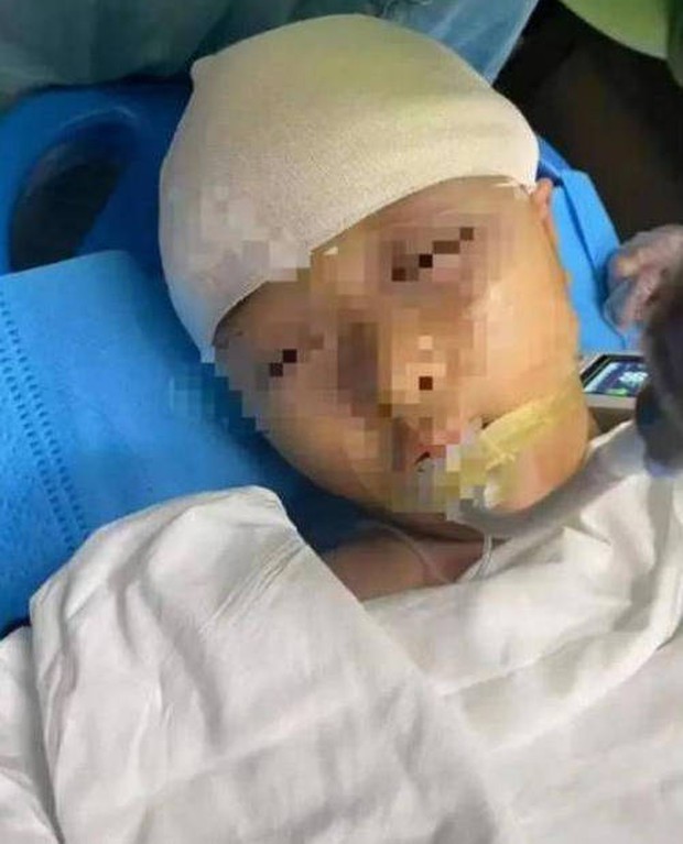 Nữ sinh lớp 4 bị thầy giáo dùng thước tác động vật lý đến mức vỡ hộp sọ, thái độ của hung thủ sau đó càng gây phẫn nộ hơn-3