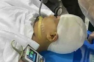 Nữ sinh lớp 4 bị thầy giáo dùng thước 'tác động vật lý' đến mức vỡ hộp sọ, thái độ của 'hung thủ' sau đó càng gây phẫn nộ hơn