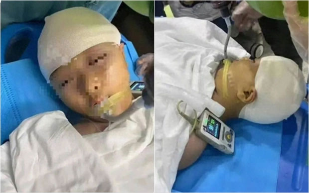 Vụ nữ sinh bị tác động vật lý đến mức vỡ hộp sọ: Quá khứ của thầy giáo bị vạch trần-1