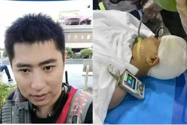 Thầy giáo đá học sinh gãy chân chỉ vì không nghỉ trưa đúng giờ-3