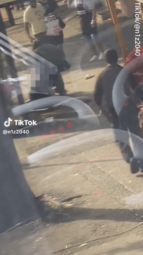 Cảnh tượng ám ảnh bé gái 11 tuổi bị chó tấn công điên cuồng-2