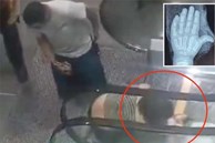 Mắc kẹt trong thang cuốn, bé gái 2 tuổi suýt mất bàn tay