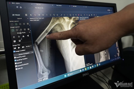 Bộ Y tế yêu cầu huy động bác sĩ giỏi để 'cấp cứu thảm họa' vụ cháy chung cư mini