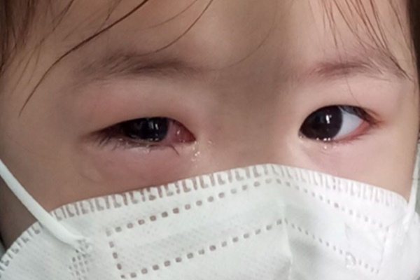 Trẻ mầm non đi học giữa mùa dịch đau mắt đỏ: Bác sĩ khuyên những việc cần làm để phòng bệnh-2