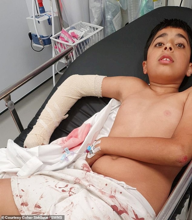 Khoảnh khắc ám ảnh: Bé trai 10 tuổi bị chó điên cuồng tấn công, bố đau đớn công khai video cảnh báo mọi người-7