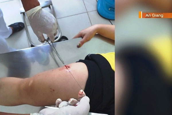 Lời hứa việc nhẹ, lương cao: Nhiều cạm bẫy chực chờ đến vật lộn để giữ được mạng sống-1