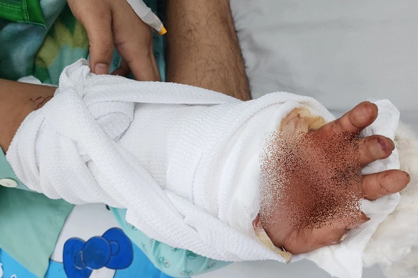 TPHCM: Chàng trai nhập viện lúc 0h với bàn tay đứt lìa bỏ vào thùng nước đá-2