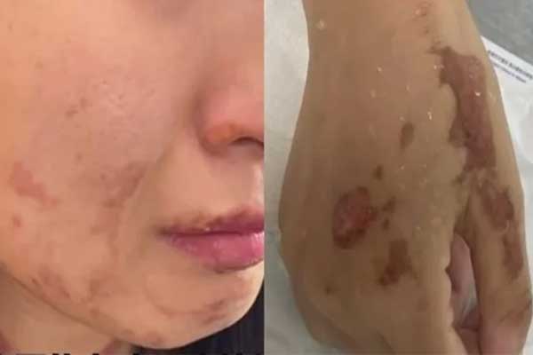 Xét nghiệm ADN dân cư cả tòa nhà 26 tầng tìm kẻ ném thuốc lá làm em bé bệnh nặng-2