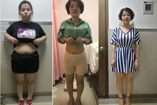 Từng nặng 83kg, cô gái trẻ giảm ngoạn mục 25kg: Bí quyết không phải nhịn ăn mà là ăn nhiều 1 thứ