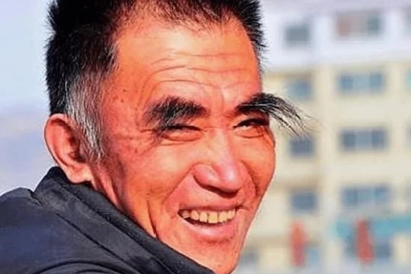 60 tuổi thấy lông mày mọc dài thì mừng vội, cứ tưởng dấu hiệu trường thọ, không ngờ bác sĩ lắc đầu thở dài-2