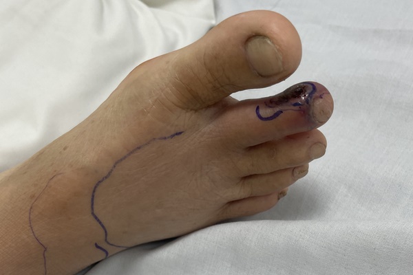 Bắt rắn độc bỏ vào cặp mang đến lớp, bé trai phải thở máy, liệt toàn thân-2