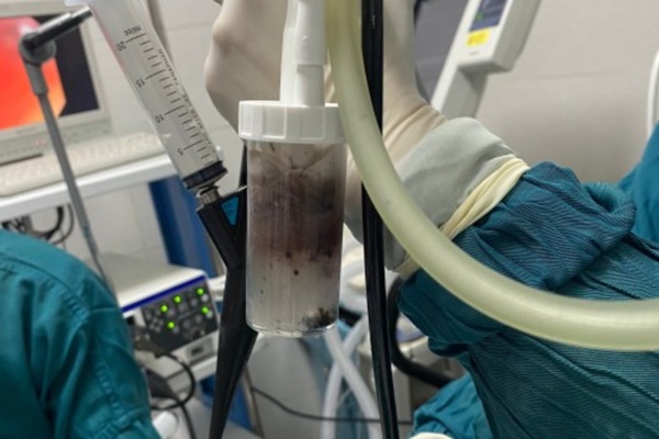 Rửa phổi cho nạn nhân vụ cháy chung cư mini, bác sĩ thấy dịch có màu đen sì-1