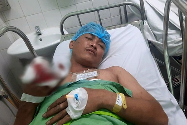 Mật phục, bắt hai đối tượng buôn 26.000 viên ma túy tổng hợp-4