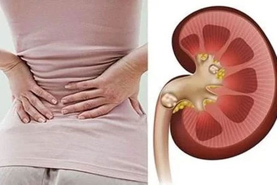 Thói quen tưởng vô hại nhưng lại là nguyên nhân khiến thận chứa cả 