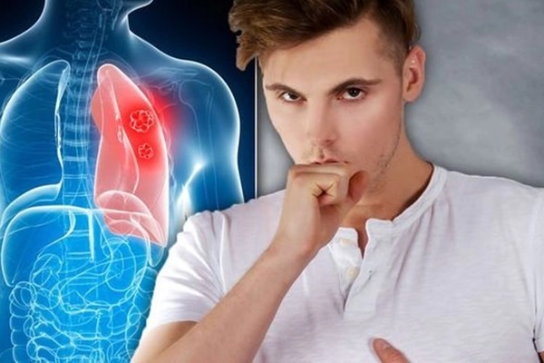 Cách nhận biết dấu hiệu khi ho cảnh báo nguyên nhân do ung thư phổi-1