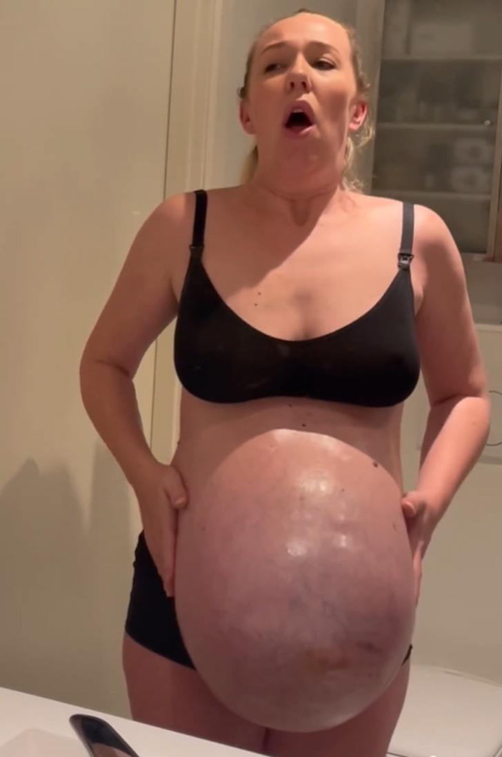 Người mẹ khoe bụng bầu như muốn nổ tung, choáng với chiếc bụng sau khi sinh-2