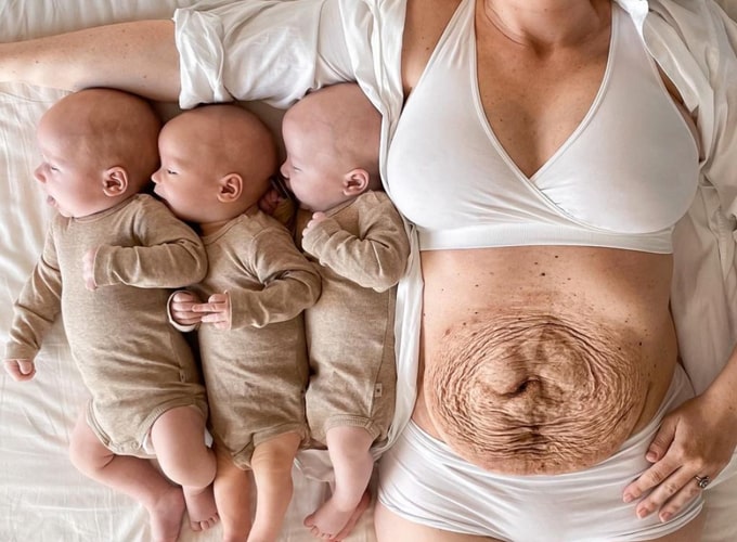 Người mẹ khoe bụng bầu như muốn nổ tung, choáng với chiếc bụng sau khi sinh-4