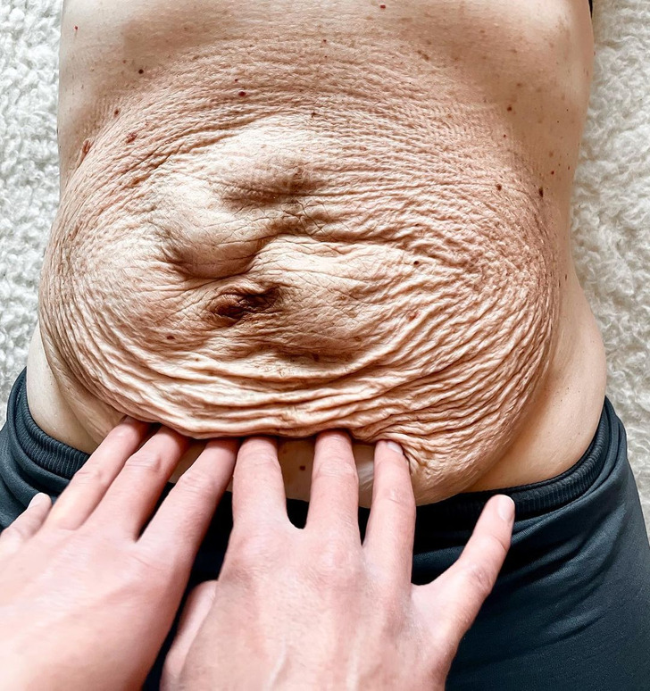 Người mẹ khoe bụng bầu như muốn nổ tung, choáng với chiếc bụng sau khi sinh-5