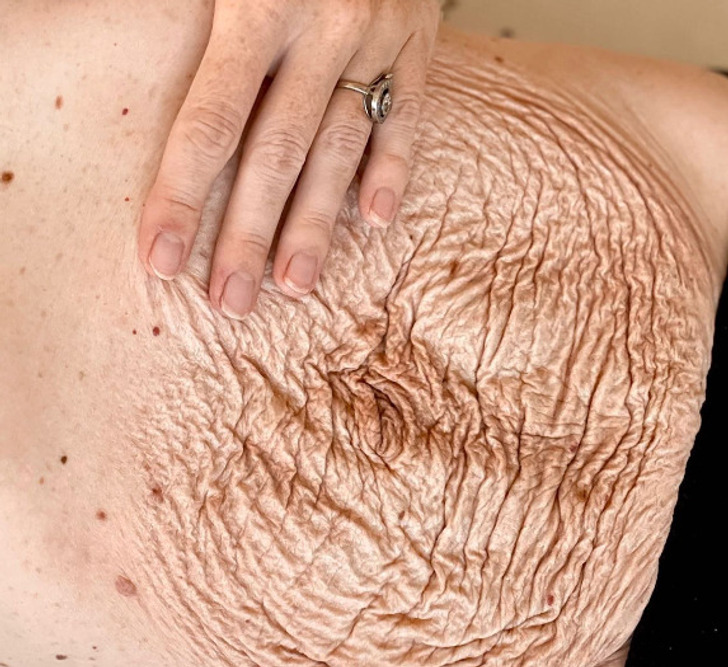 Người mẹ khoe bụng bầu như muốn nổ tung, choáng với chiếc bụng sau khi sinh-6