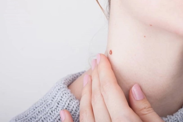 Trên cổ có 3 thay đổi này thì nên sớm đi tầm soát ung thư-2