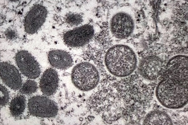 Chuyên gia Viện Pasteur TP. Hồ Chí Minh nhận định gì về nguy cơ lây lan bệnh đậu mùa khỉ?-1
