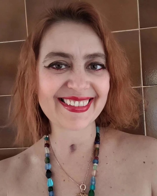 Người phụ nữ hôn mê, tê liệt toàn thân sau khi ăn đồ hộp hết hạn-1