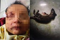 Cháu bé sơ sinh nghi bị chuột cắn nhiều vết thương ở mặt