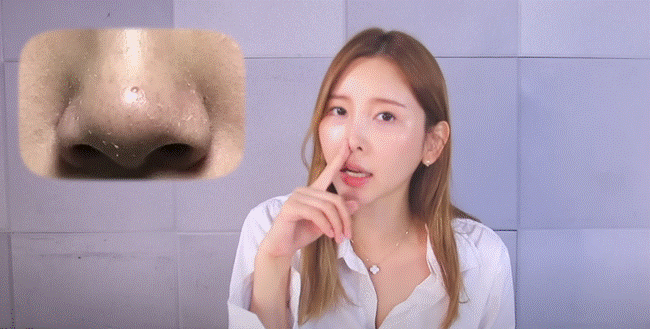 Cách lấy nhân mụn đầu đen tại nhà hiệu quả mà không làm hại da-3