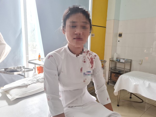 Nữ sinh dùng guốc đánh bạn cùng lớp tóe máu đầu-1