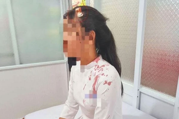 Tận cùng nỗi đau khi có con bị đánh đến hoảng loạn, gọi bố mẹ là côn đồ tốt-6