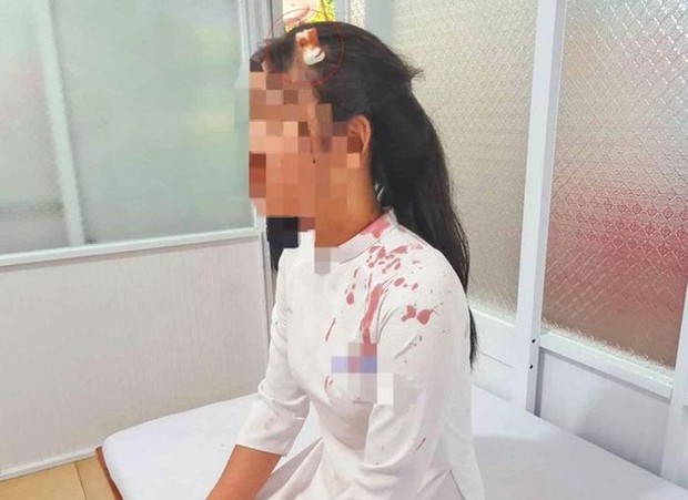 Diễn biến mới vụ nữ sinh đánh bạn đổ máu-1