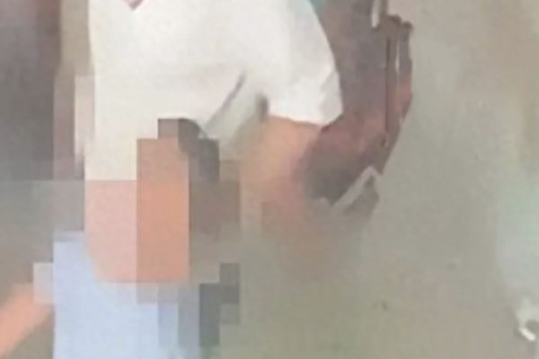 Bị mẹ bạo hành phải cắt cụt 2 bàn chân, bé trai vẫn nhớ thương, mong gặp lại-2