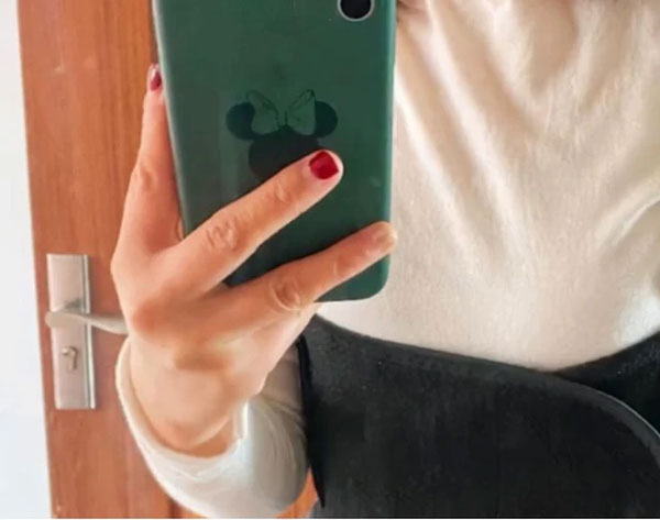 Nữ sinh viên bị đột quỵ mắt, da nhăn nheo vì 1 thói quen nhiều người trẻ hay làm-1