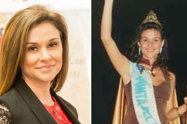 Đột quỵ sau phẫu thuật thẩm mỹ, hoa hậu người Argentina qua đời-1