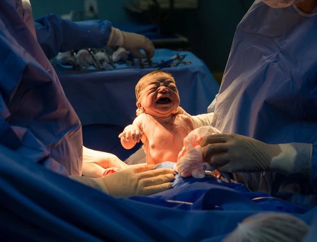 Em bé sơ sinh gây bão” với khuôn mặt gắt gỏng lúc mới chào đời-2