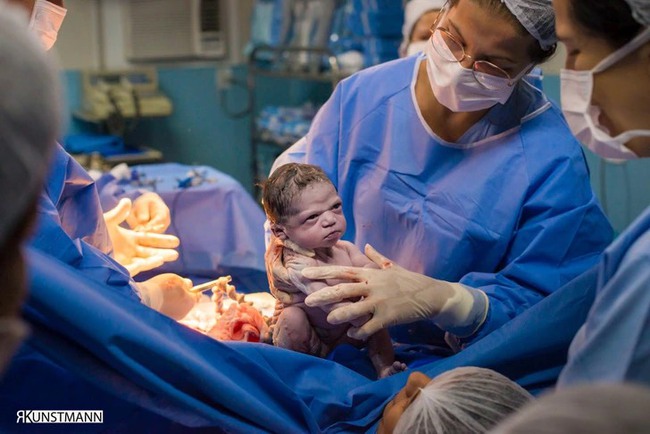 Em bé sơ sinh gây bão” với khuôn mặt gắt gỏng lúc mới chào đời-3