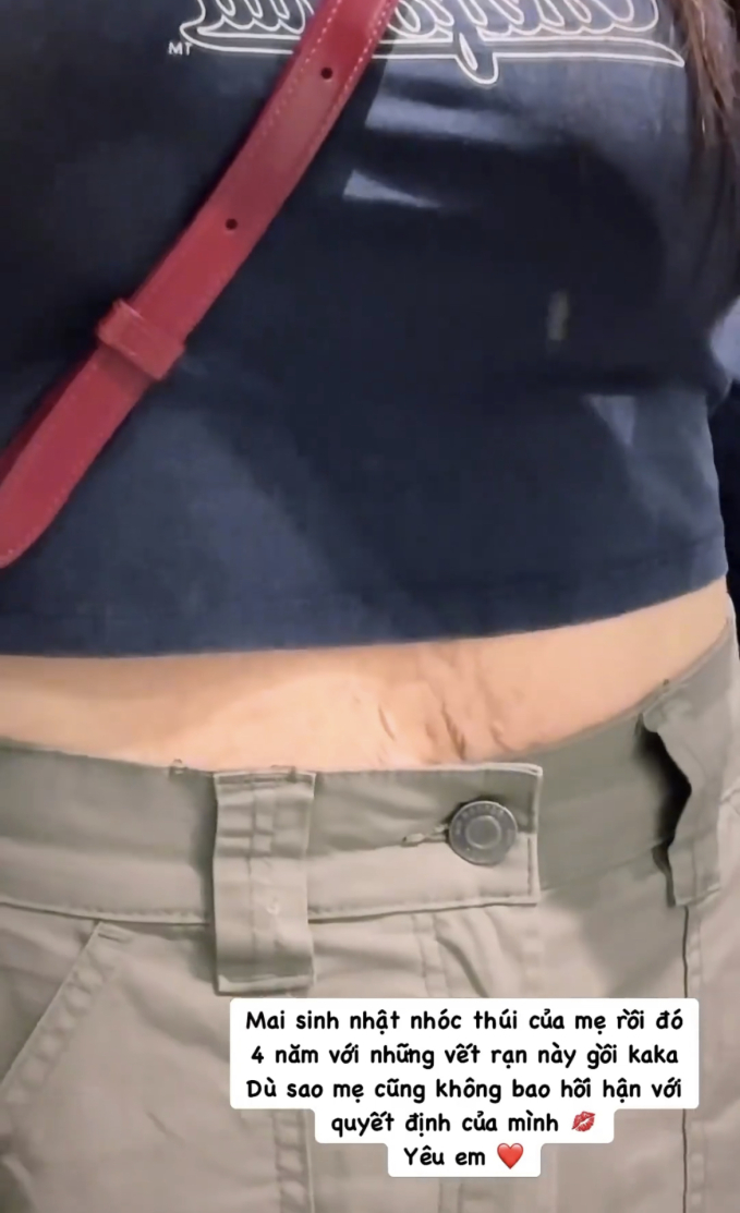 Hoà Minzy zoom cận hình ảnh những vết rạn bụng, nói gì về quyết định âm thầm sinh con 4 năm trước?-1