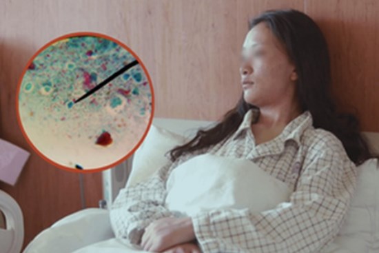 Cô gái 21 tuổi bị sán bám 