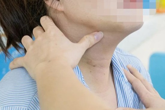 Đi khám sức khỏe, nhiều người trong cùng gia đình phát hiện mắc ung thư tuyến giáp