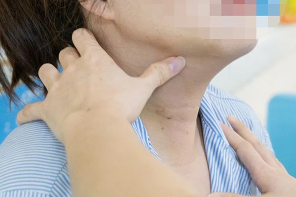 Đi khám sức khỏe, nhiều người trong cùng gia đình phát hiện mắc ung thư tuyến giáp-1