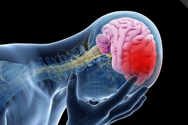 Đột quỵ sẽ tăng vọt, đặc biệt ở châu Á: Cảnh báo 4 lý do chính-1