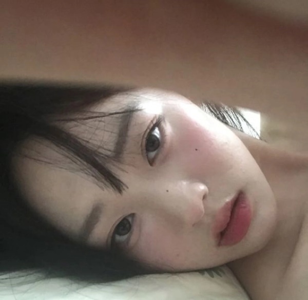 Ung thư rất dễ ngụy trang” dưới hình dạng của 4 loại mụn này-1