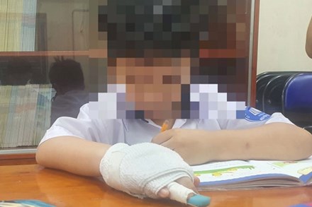 Cơ quan chức năng vào cuộc vụ giáo viên bị tố đánh gãy xương ngón tay học sinh