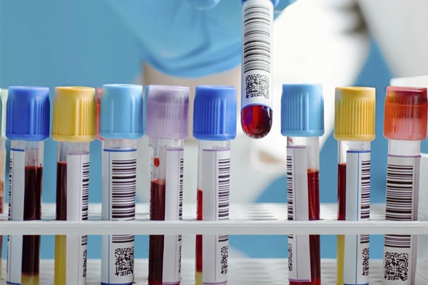 Đặc điểm 2 cao 4 thấp ở những người sống thọ 100 tuổi-1