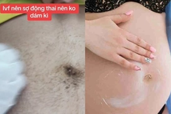 Hiếm muộn 4 năm mới có con nhờ IVF, mẹ bầu sợ động thai không dám vệ sinh bụng, người chê trách, người thương cảm