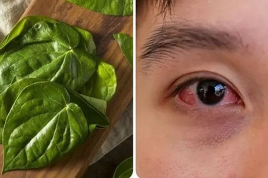 Chữa đau mắt đỏ bằng lá trầu không có thực sự hiệu quả?